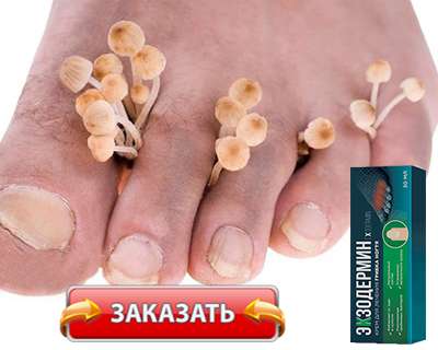 Заказать Экзодермин на официальном сайте.