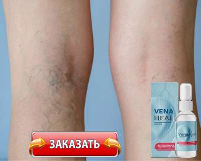 Заказать VenaHeal на официальном сайте.