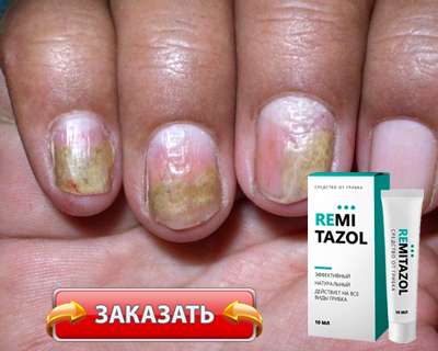Заказать Ремитазол на официальном сайте.