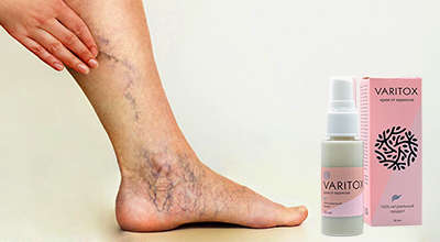 varitoks-ot-varikoza